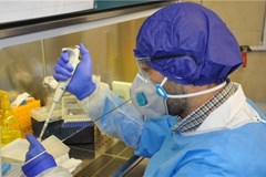 Iranian Scientists Design Kits to Diagnose Coronavirus in 55 Minutes