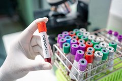 Montenegro offers sympathy with Iran over coronavirus victims
